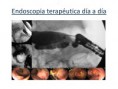 /album/ubicacion-aberrante-de-papila/asenda-papila-bulboduodenal-1-9-jpg/